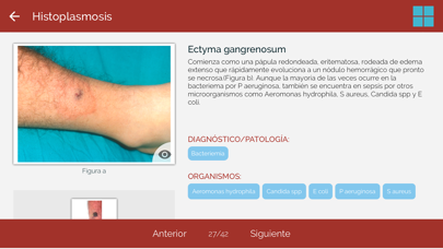 Dicc. Enfermedades infecciosas screenshot