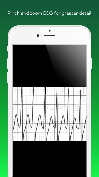ECG Challenge