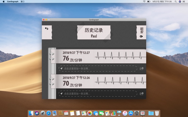 心电图 (Cardiograph) screenshot