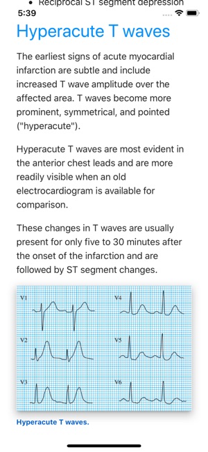 ECG Basics Pro - ECG Made Easy(圖2)-速報App