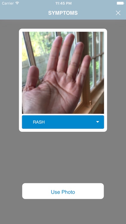 LupusMinder screenshot-4