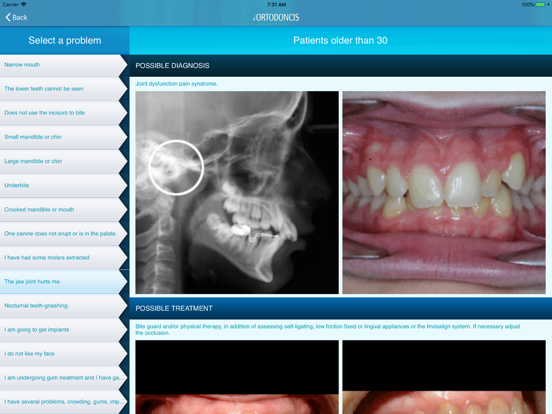 iOrtodoncis iPad screenshot 2 - Medical app