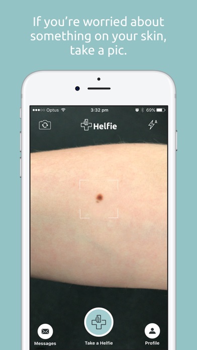 Helfie - Prevent Skin Cancer screenshot 2