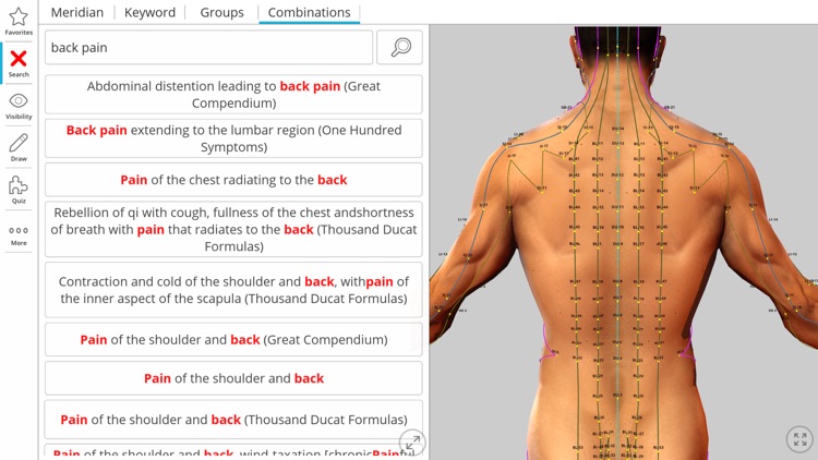 Visual Acupuncture 3D screenshot-3