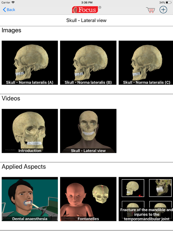 Screenshot #6 pour Head and Neck