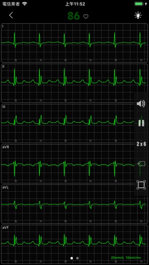 ECG - 海量心電圖案例和診斷詳解(圖3)-速報App