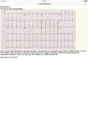 ekg academy ipad images 3