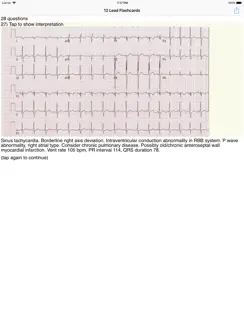 EKG Academy iPad image 3