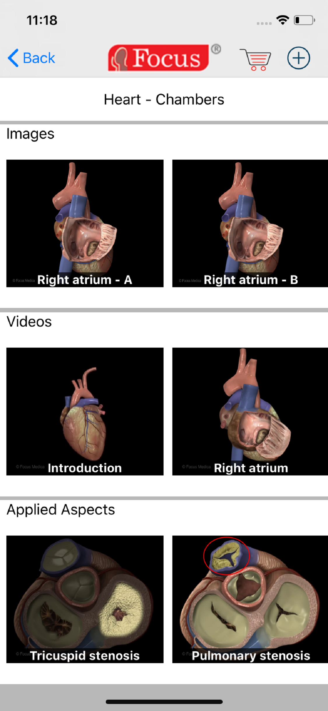 HEART -  Digital Anatomy