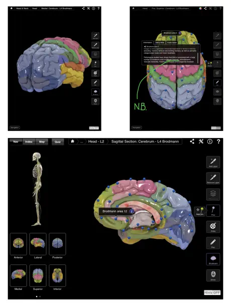 Brain & Nervous System Pro III