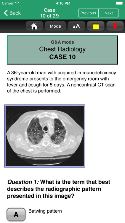 Pulmonary Disease Review