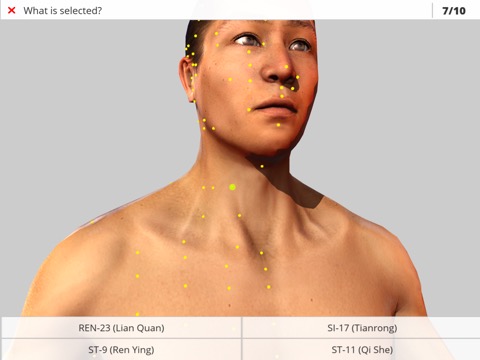 Visual Acupuncture 3Dのおすすめ画像3