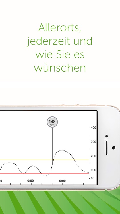 Dexcom G5 Mobile mg/dL DXCM1