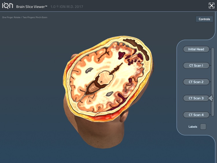 ION Brain Slice Viewer screenshot-3