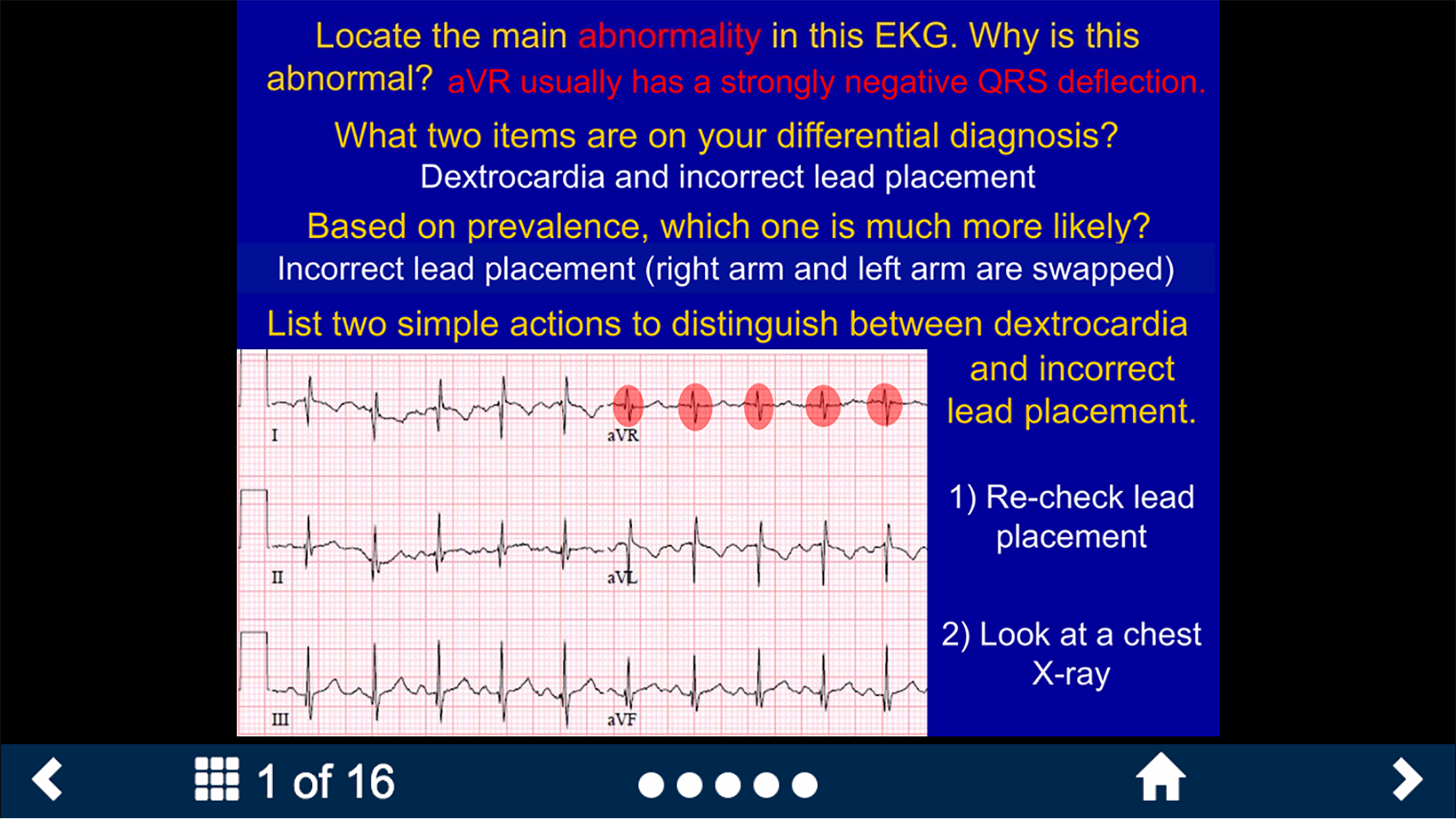 EKG - SecondLook