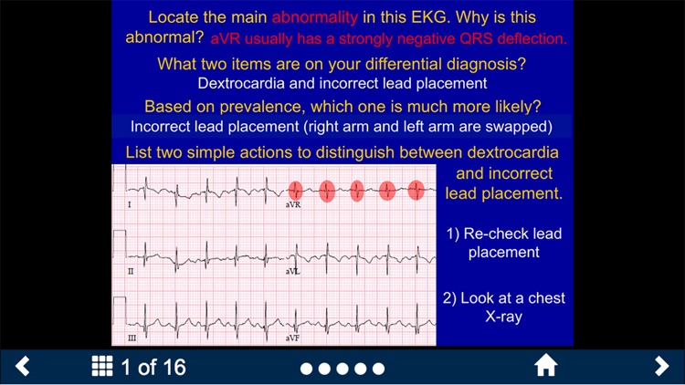 EKG - SecondLook screenshot-3