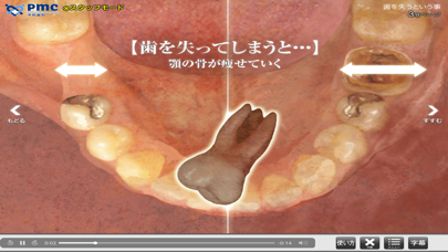 Screenshot #3 pour dental-pmc