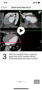 Cardiac Imaging Planes 1-2-3 screenshot #1 for iPhone