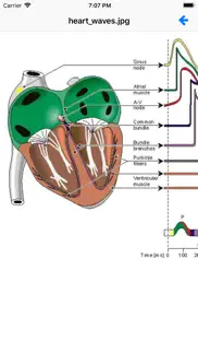 ekg academy iphone screenshot 3