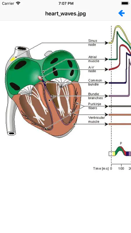 EKG Academy screenshot 3 of 4