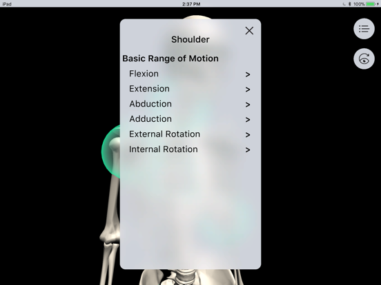 Screenshot #5 pour Musculoskeletal Pro Consult
