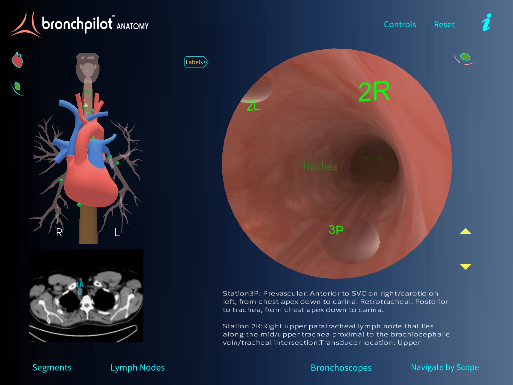 BronchPilot ANATOMY screenshot 3