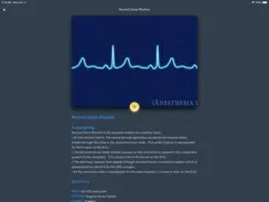 ACLS Rhythms and Quiz iPad image 4