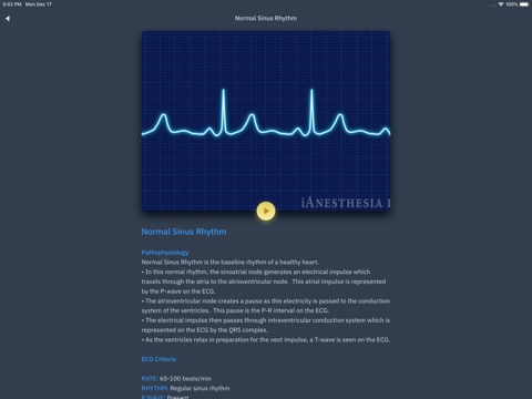 ACLS Rhythms and Quizのおすすめ画像4