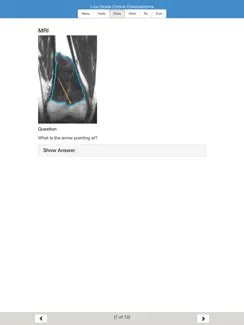 MSK Oncology Educational Atlas iPad image 2
