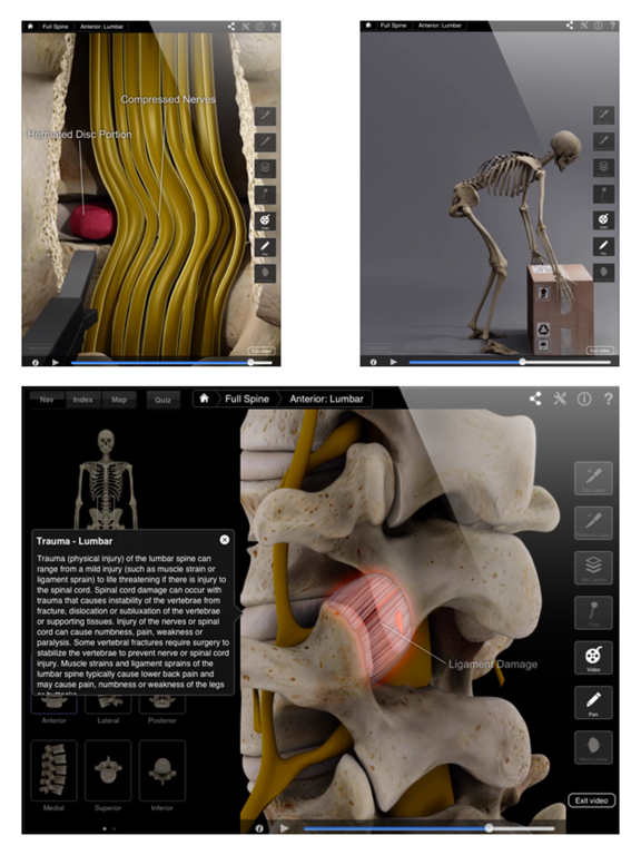 Spine Pro IIIのおすすめ画像2