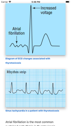 ECG Basics Lite: ECG Made Easy screenshot 2
