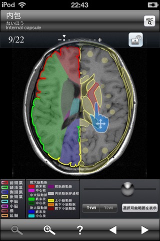 断面図ウォーカー脳MRIのおすすめ画像2