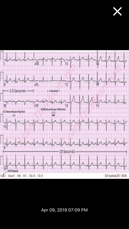 Lumi Video Digitizer screenshot-5