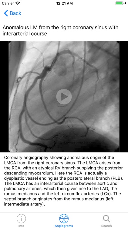 CARDIO3® Interventional Atlas