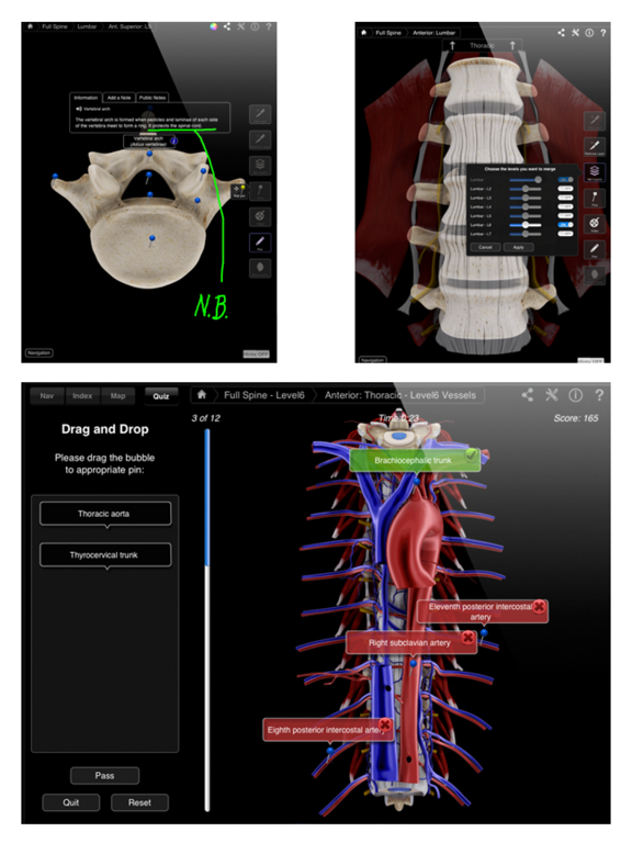 Spine Pro IIIのおすすめ画像5