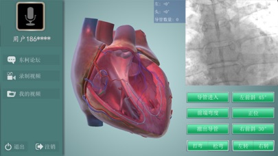 3D Heart screenshot 2