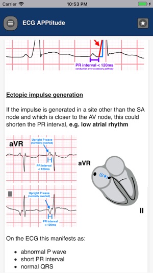 ECG APPtitude(圖5)-速報App