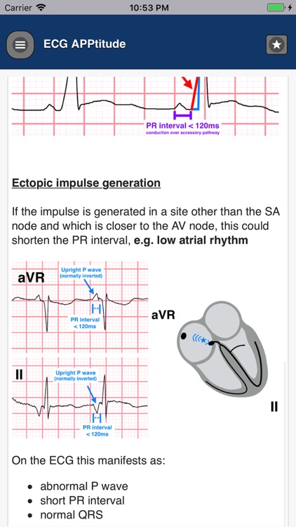 ECG APPtitude screenshot-4