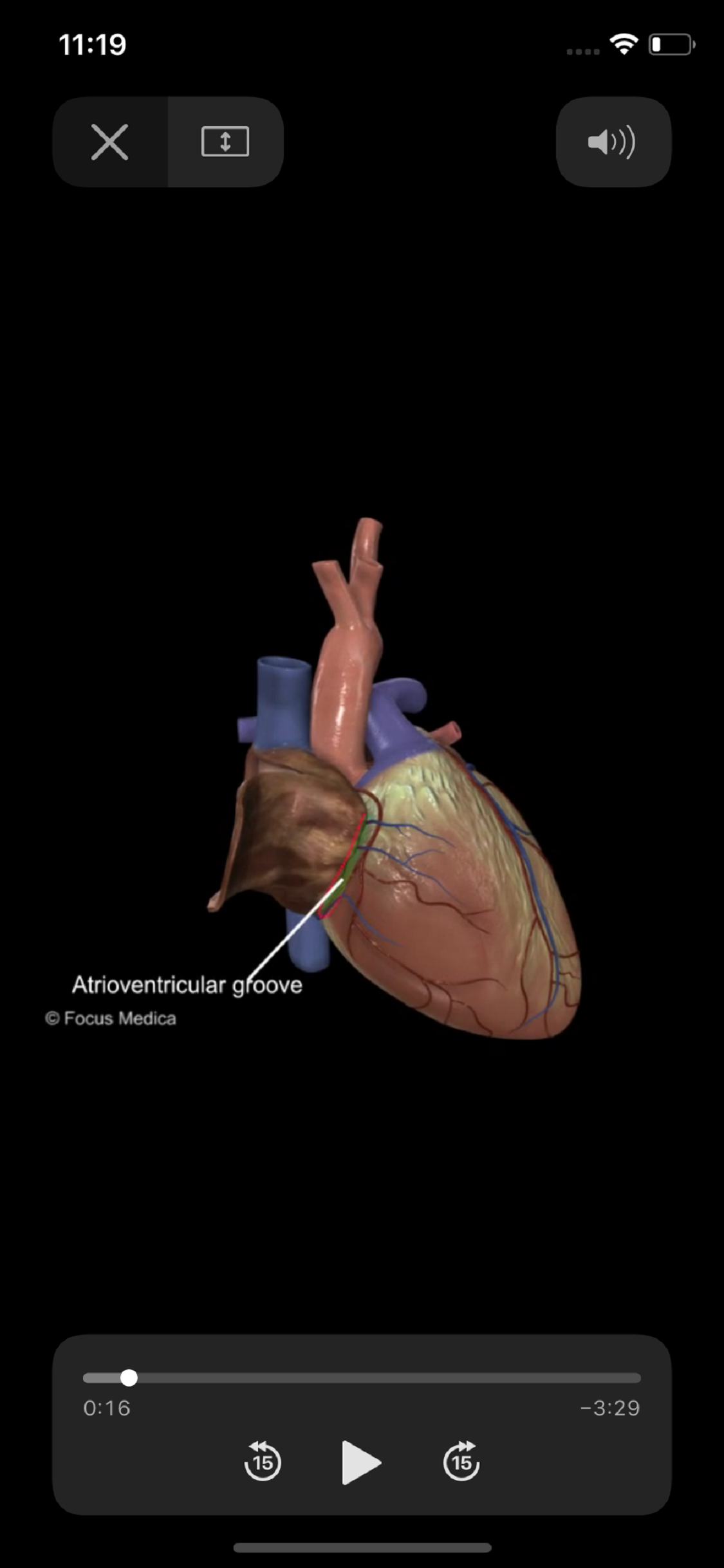HEART -  Digital Anatomy