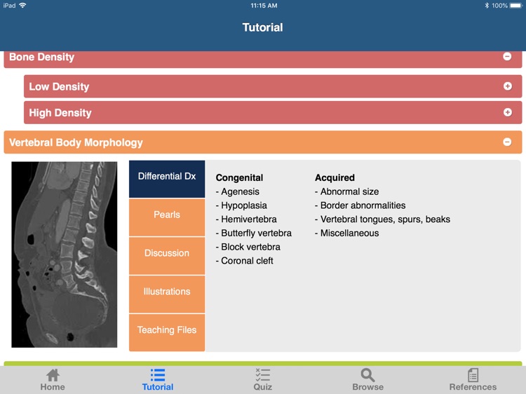 CTisus L-Spine Pathology