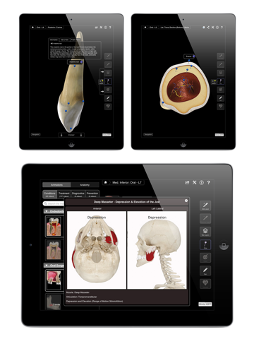 Dental Patient Education Lite screenshot 4