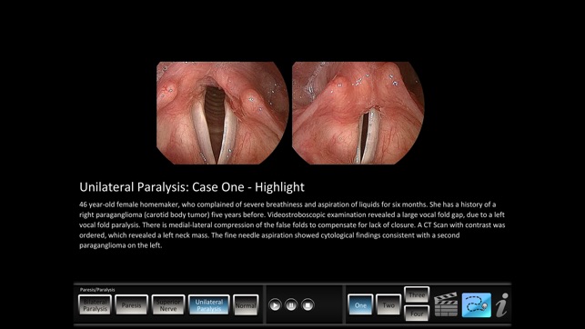 Paresis/Paralysis(圖2)-速報App