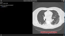 fibrose pulmonaire 2017 айфон картинки 2