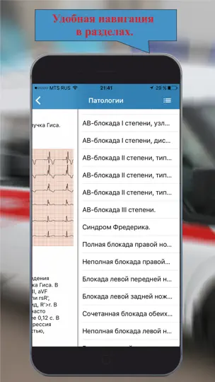 Скриншот ЭКГ: Расшифровка и тесты. на iPhone 2