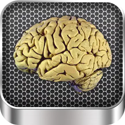 Brain Anatomy Читы