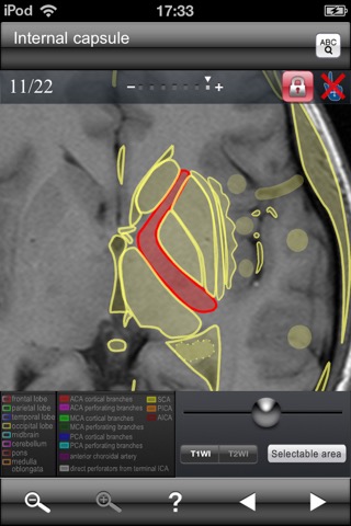 Brain MRI Sectional Walkerのおすすめ画像5