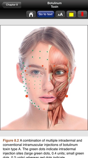 Botulinum Toxin(圖4)-速報App