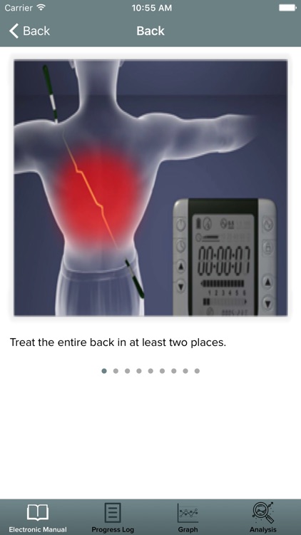 Alpha-Stim screenshot-3