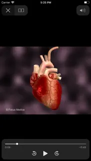 cardiovascular medicine iphone screenshot 4