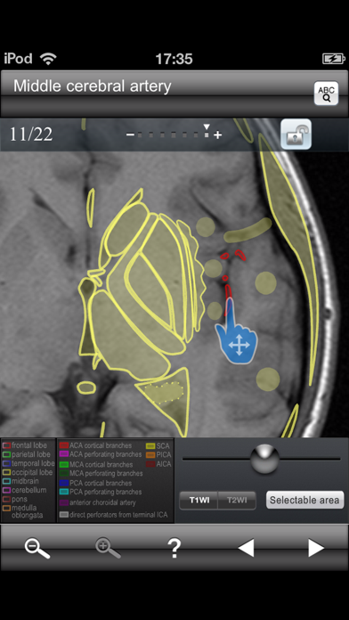 Brain MRI Sectional Walker Screenshot 5